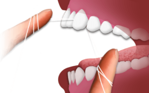 flossing-teeth-schaumburg-IL